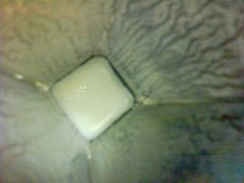 What is it? / ***